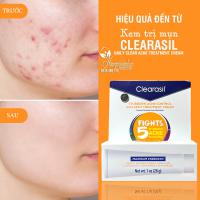 Kem trị mụn Clearasil Daily Clear Acne Treatment Cream 28g của Mỹ