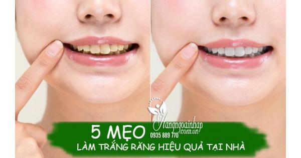 Bật mí 5 mẹo làm trắng răng hiệu quả tại nhà, an toàn