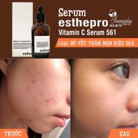 Vitamin C Serum 561 Esthepro dưỡng trắng da của Hàn Quốc