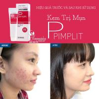 Kem Thoa Trị Mụn Shiseido Pimplit 15g Của Nhật Bản