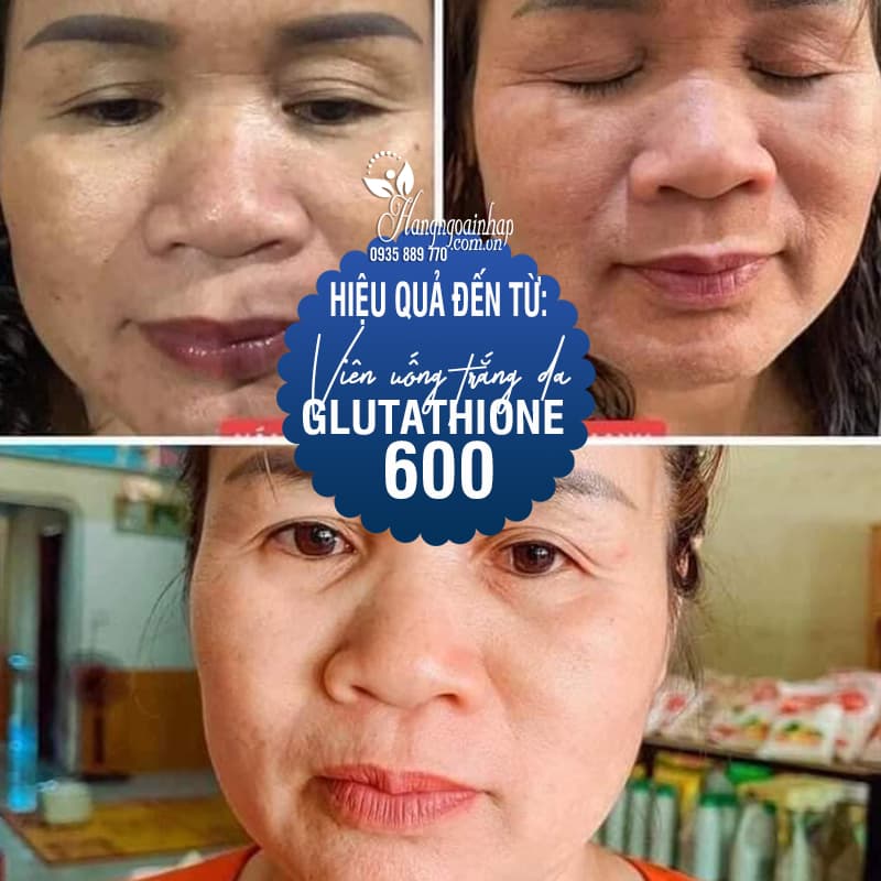 glutathione 600 uống bao lâu thì ngưng Uống Glutathione bao lâu thì trắng? Có nên uống Glutathione không? main image 0