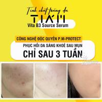 Serum dưỡng trắng phục hồi da Tiam Vita B3 Source Hàn Quốc