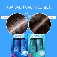 Bộ gội xả H&S của Nhật Bản - Đặc trị gàu siêu hiệu quả