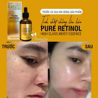 Tinh chất chống lão hóa Pure Retinol High Class Moist Essence