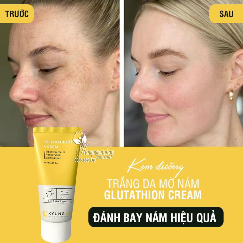 just glow glutathione relumins 1650mg glutathione Your skin doesn't just need glow on the surface  — it needs antioxidant