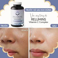 Viên uống trắng da Relumins Vitamin C Complex 180 viên của Mỹ