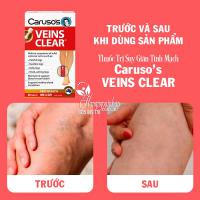 Thuốc trị suy giãn tĩnh mạch Caruso’s Veins Clear 60 viên của Úc