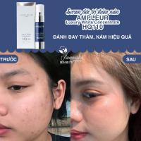 Serum đặc trị thâm nám Ampleur Luxury White Concentrate HQ110