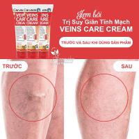 Kem bôi trị suy giãn tĩnh mạch Carusos Veins Care Cream Úc