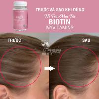 Viên uống Biotin Myvitamins 90 viên hỗ trợ mọc tóc