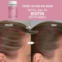 Viên uống Biotin Myvitamins 90 viên hỗ trợ mọc tóc
