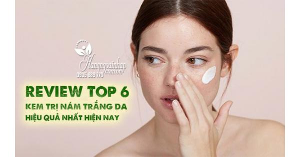 Review top 6 kem trị nám trắng da hiệu quả nhất hiện nay