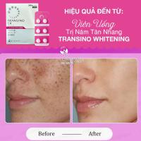 Viên Uống Trị Nám Tàn Nhang Transino Whitening Hộp 240 Viên