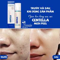 Nước hoa hồng rau má Centella Medi Peel 180ml Hàn Quốc