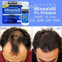 Thuốc Mọc Tóc Trị Hói Đầu Minoxidil 5% Kirkland Của Mỹ