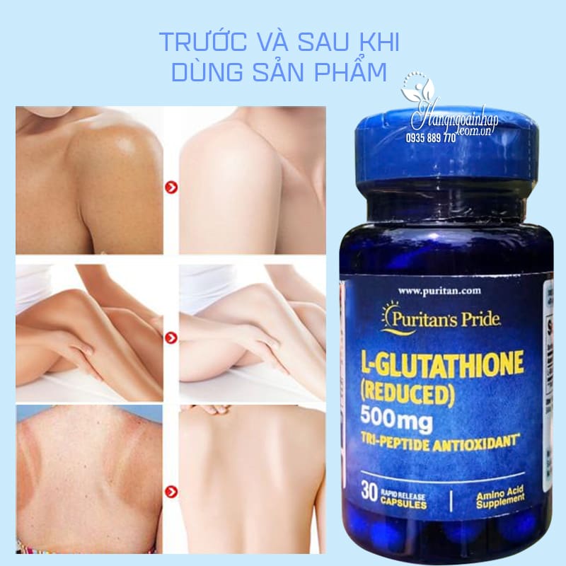 best glutathione supplement brands india NATROCEUTICS Glutathione SOD