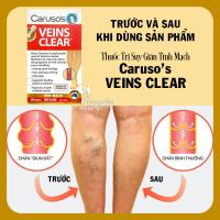 Thuốc trị suy giãn tĩnh mạch Caruso’s Veins Clear 60 viên của Úc