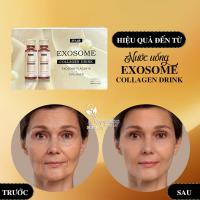 Nước uống Exosome Collagen Drink JT-Lab Nhật Bản 12 chai
