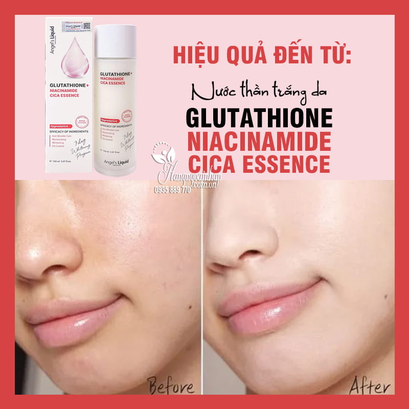 glutathione dạng nước Nước thần trắng da Glutathione Niacinamide Cica Essence 150ml