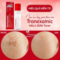 Nước hoa hồng giảm thâm nám Tranexamic Mela Zero Toner 150ml