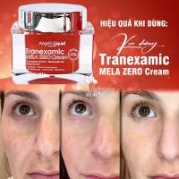 Kem dưỡng Tranexamic Mela Zero Cream Angel’s Liquid 50ml 