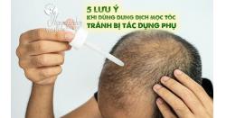5 lưu ý khi dùng dung dịch mọc tóc tránh bị tác dụng phụ 