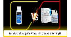Minoxidil 2% và 5% khác nhau thế nào? Sự thật từ chuyên gia!
