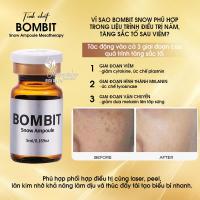 Tinh chất Bombit Snow Ampoule Mesotherapy 4 lọ của Hàn Quốc