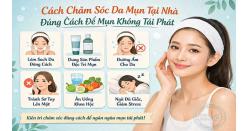 Cách chăm sóc da mụn tại nhà đúng cách để mụn không tái phát