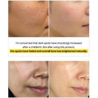 Set 2 ống tinh chất dưỡng trắng da C-Toning Daily Shot Hàn Quốc