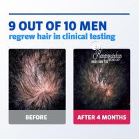 Bọt hỗ trợ mọc tóc cho nam Men’s Rogaine Minoxidil 5% Foam