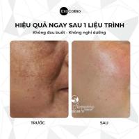 Tinh chất Exosome Exocode Radiance - R set 3 cặp của Hàn Quốc