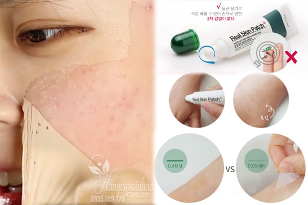 Gel che mụn thần thánh Not4U Real Skin Patch 15g của Hàn Quốc