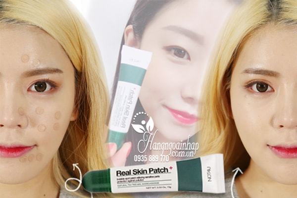 Gel che mụn thần thánh Not4U Real Skin Patch 15g của Hàn Quốc