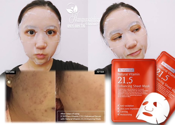 Mặt nạ Natural Vitamin 21.5 Enhancing Sheet Mask Hàn Quốc