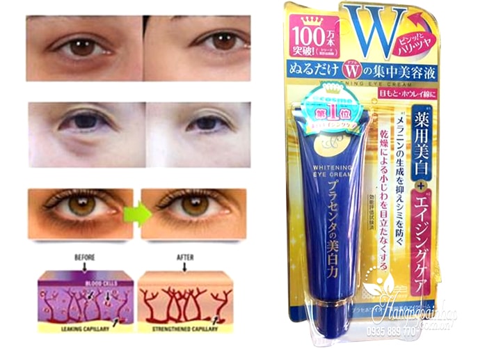 Kem trị thâm và nhăn mắt Meishoku Whitening Eye Cream 30g 