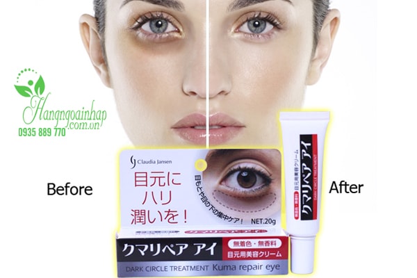 Kem trị thâm quầng mắt Kuma Repair Eye Cream 20g của Nhật Bản