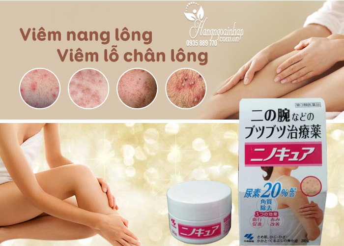 Kem trị viêm lỗ chân lông Kobayashi 30g của Nhật Bản