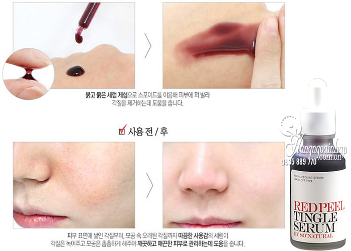 Peel da không bong tróc Red Peel Tingle Serum - Tái tạo da 1