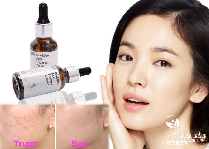 Serum đặc trị mụn Dew & Dew Acne Treatment Ampoule 30ml 