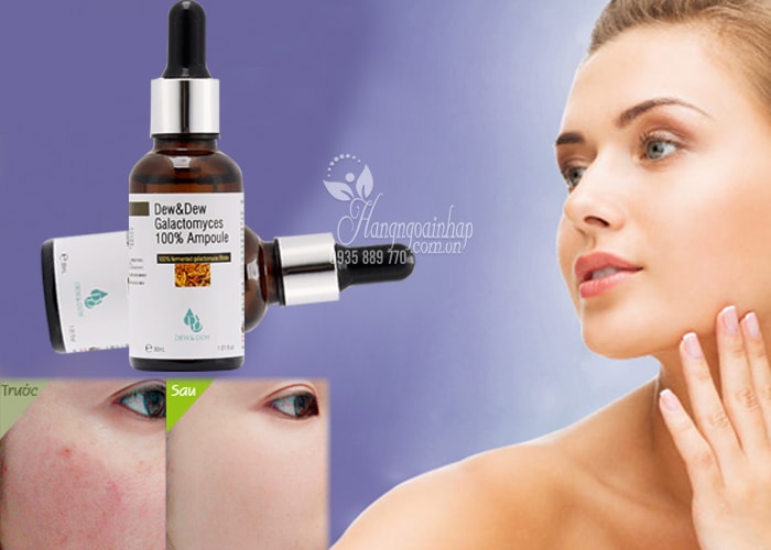 Serum dưỡng trắng Dew&Dew Galactomyces 100% Ampoule 30ml 
