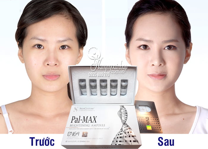 Set cấy trắng và căng bóng da Pal-Max Brightening Ampoule Hàn 1