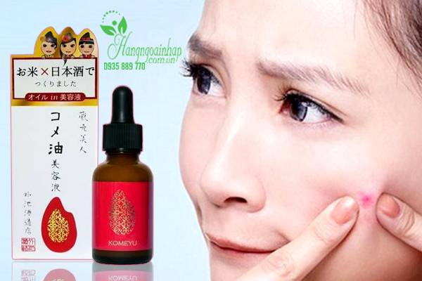 Serum làm sáng da, giảm thâm mụn Rice And Beer Komeyu 30ml của Nhật