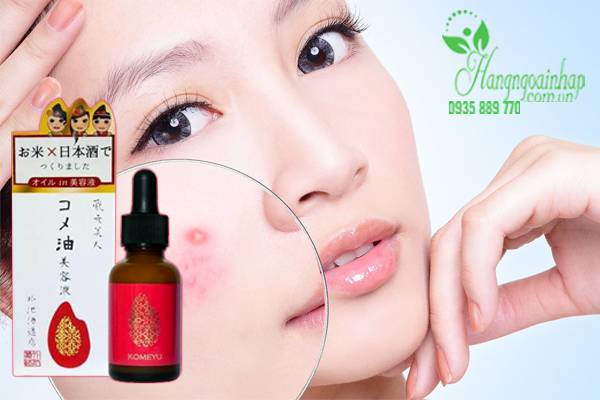 Serum làm sáng da, giảm thâm mụn Rice And Beer Komeyu 30ml của Nhật