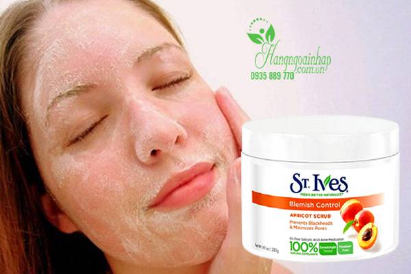 Kem tẩy tế bào chết St.Ives Blemish Control Apricot Scrub 283g của Mỹ