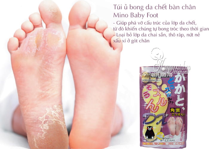 Túi ủ bong da chết bàn chân Mino Baby Foot Nhật Bản 2