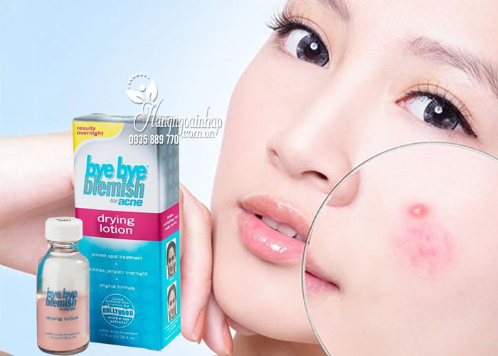 Lotion trị mụn Bye Bye Blemish Drying Lotion của Mỹ 3