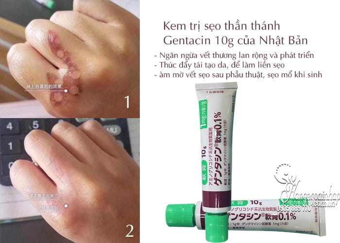 Kem trị sẹo thần thánh Gentacin 10g tốt nhất của Nhật Bản 3