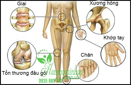 bí quyết hỗ trợ giảm đau nhức xương khớp