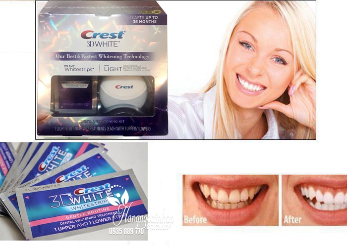 Bộ sản phẩm tẩy trắng răng Crest 3D White No Slip Whitestrips With Light